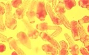 In vitro developmental stages of Echinococcus granulosus